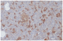 Paraffin embedded human pancreas stained with Mouse anti Human somatostatin receptor 1